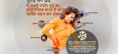 Stone Out Forte Capsules – Stone Remedies, Price in India! Order