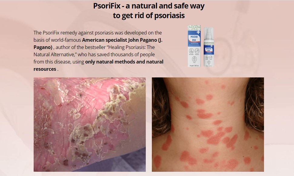 PsoriFix Remedy Against Psoriasis