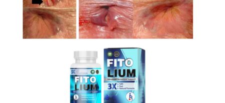 Fitolium Capsules – Uses, Side Effects, Benefits, Price in India!
